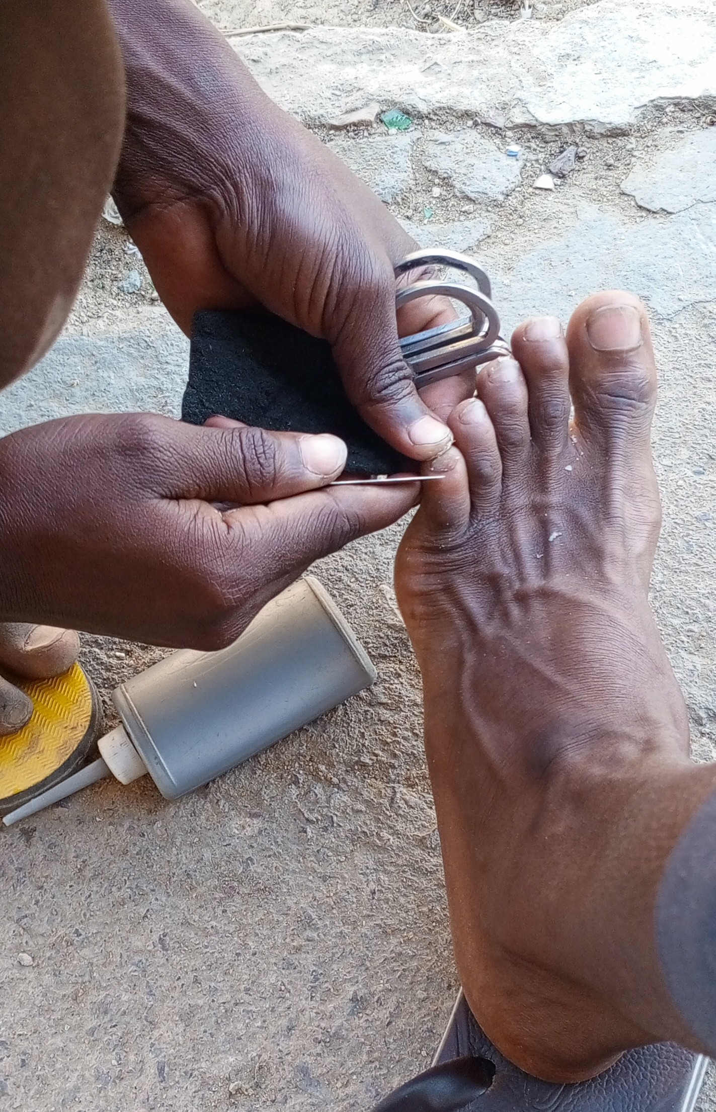 Tchad/Société: Pratique de coupe d’ongle chez les ambulants, un danger ambulant !